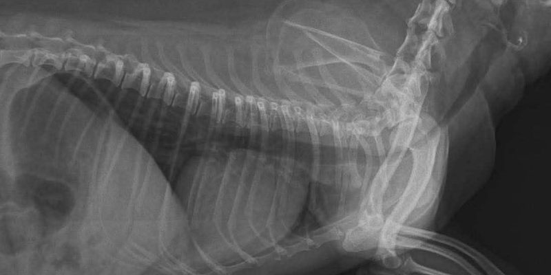 Hình ảnh x-quang trước khi đặt sent khí quảng