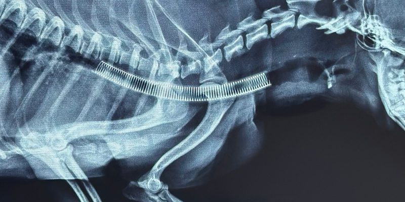 Hình ảnh x-quang sau khi đặt sent khí quảng