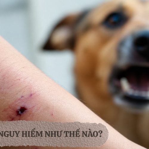 Bệnh dại nguy hiểm như thế nào?